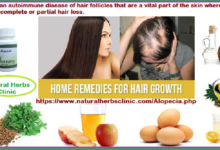 Hair-Growth-Solutions-for-Fighting-Alopecia