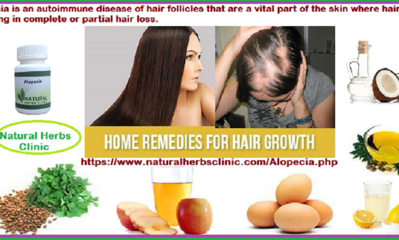Hair-Growth-Solutions-for-Fighting-Alopecia