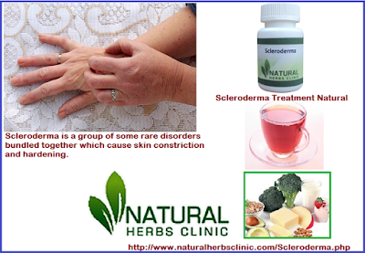 C Scleroderma Treatment Natural Scleroderma Alternative Treatments Natural Treatment for Scleroderma - Natural Herbs Clinic