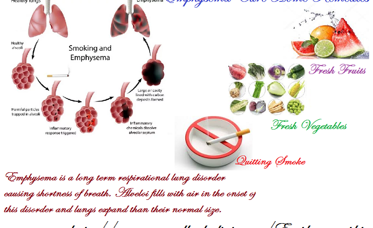 Emphysema-Cure-Home-Remedies