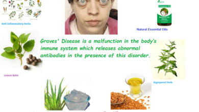 Graves’ Disease Herbal Treatment