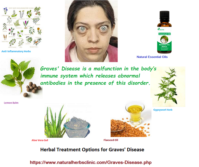 Graves' Disease Herbal Treatment Causes, Symptoms, Treatment