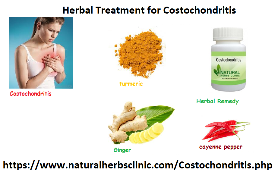 Herbal Treatment for Costochondritis Cause, Symptoms Natural Herbs