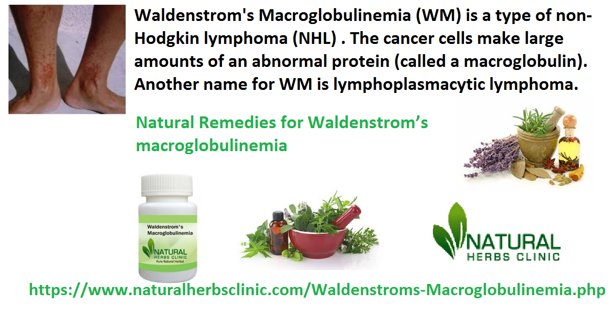 Natural Remedies for Waldenstrom’s Macroglobulinemia