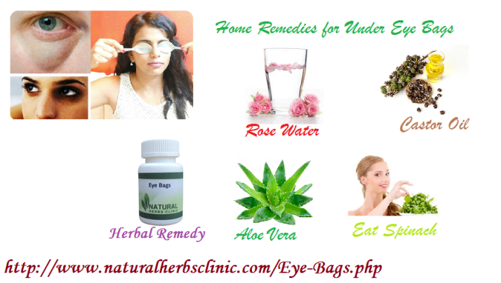 home-remedies-for-eye-bags-do-they-really-work