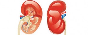 Polycystic Kidney Disease