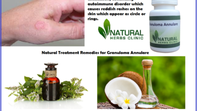 Granuloma-Annulare-in-Adults-Granuloma-Annulare-Natural-Treatment-Natural-Treatment-for-Granuloma-Annulare