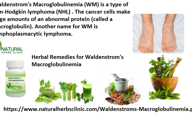 Herbal-Remedies-for-Waldenstroms-Macroglobulinemia