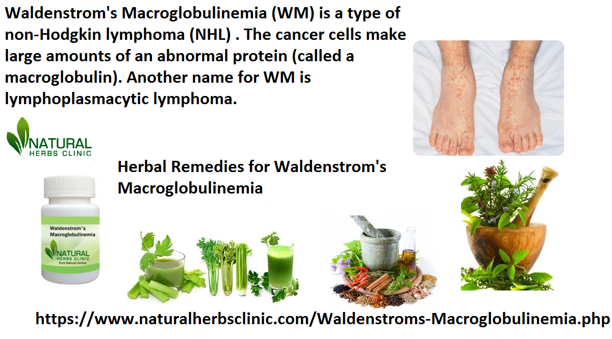 Herbal Remedies for Waldenstrom's Macroglobulinemia
