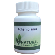 Lichen Planus Treatment