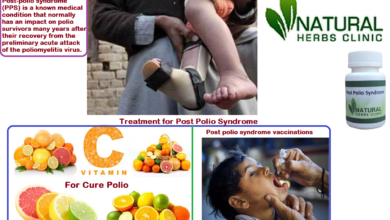 Herbal Remedies for Post Polio Syndrome