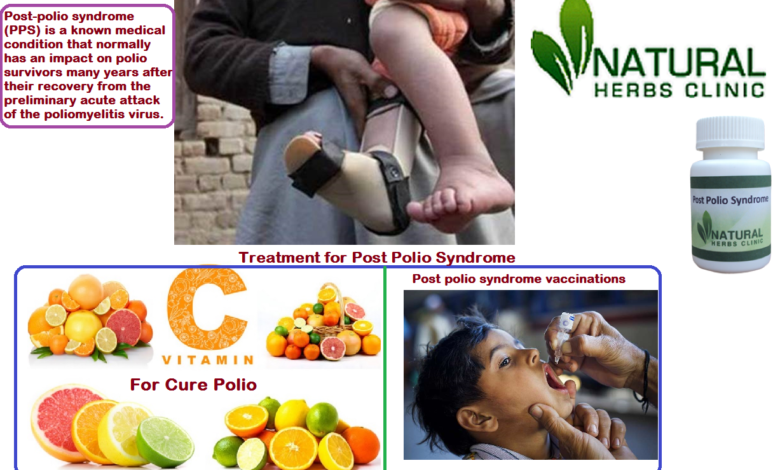 Herbal Remedies for Post Polio Syndrome