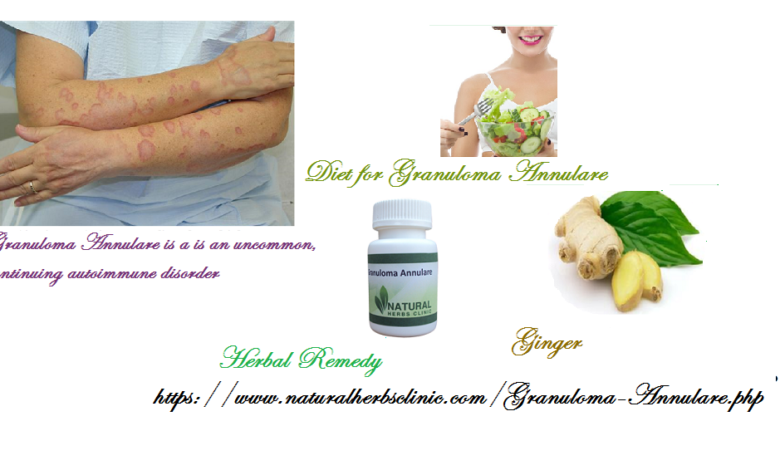 Natural-Treatment-for-Granuloma-Annulare