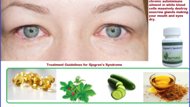 Natural Remedies for Sjogren’s Syndrome