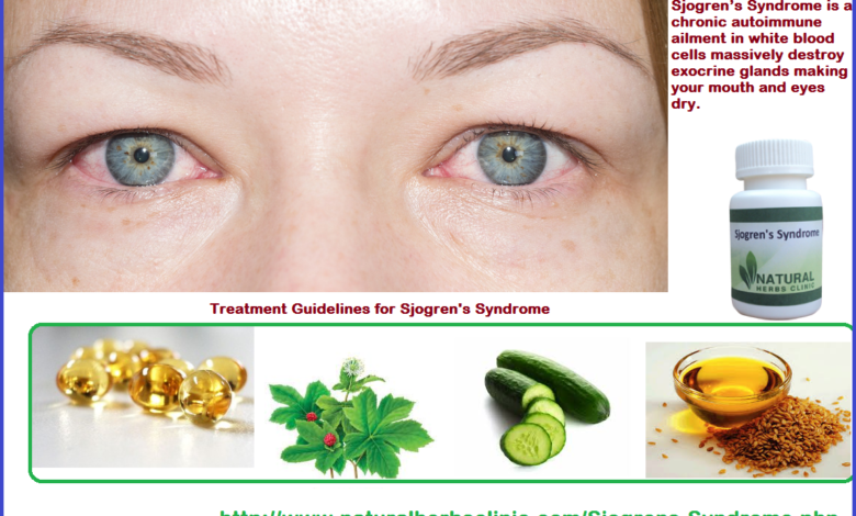 Natural Remedies for Sjogren’s Syndrome