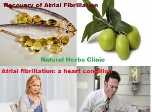 Atrial-Fibrillation-Natural-Treatment-300x267