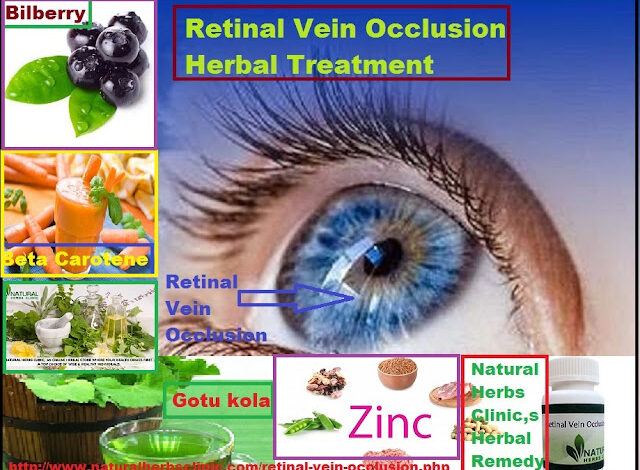 Retinal Vascular Occlusion Treatment