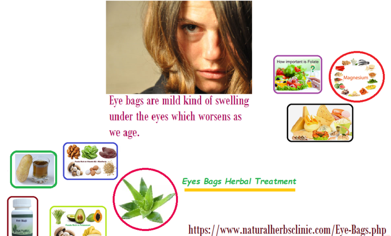 Eyes-Bags-Herbal-Treatments-1