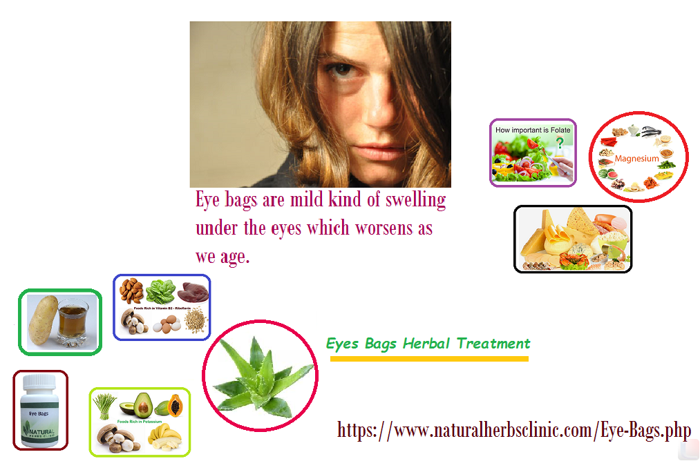 7 Home Remedies for Eye Bags Natural Herbs Clinic Blog