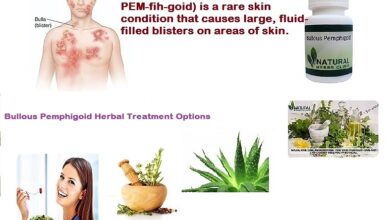 Pemphigoid-Natural-Herbal-Treatment