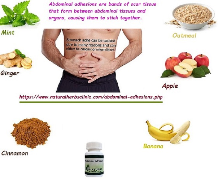 Abdominal Adhesions Herbal Treatment