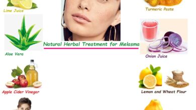 7-Easy-Home-Herbal-Remedies-for-Melasma