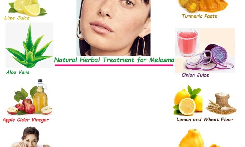 7-Easy-Home-Herbal-Remedies-for-Melasma