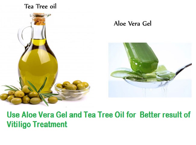 Aloe Gel and Tea Tree Oil