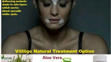 Natural-Treatment-of-Vitiligo-with-Aloe-Vera