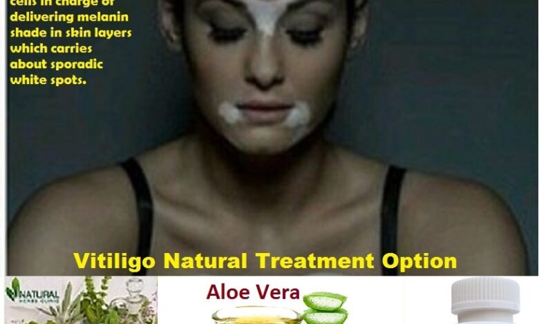 Natural-Treatment-of-Vitiligo-with-Aloe-Vera