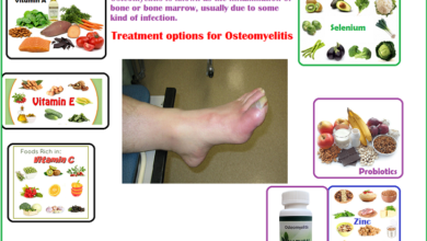 B-Osteomyelitis-Pain-Relief