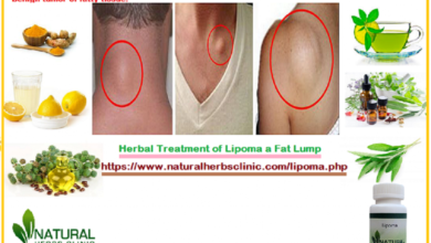 Herbal-Treatment-of-Lipoma-a-Fat-Lump-1-1024x662
