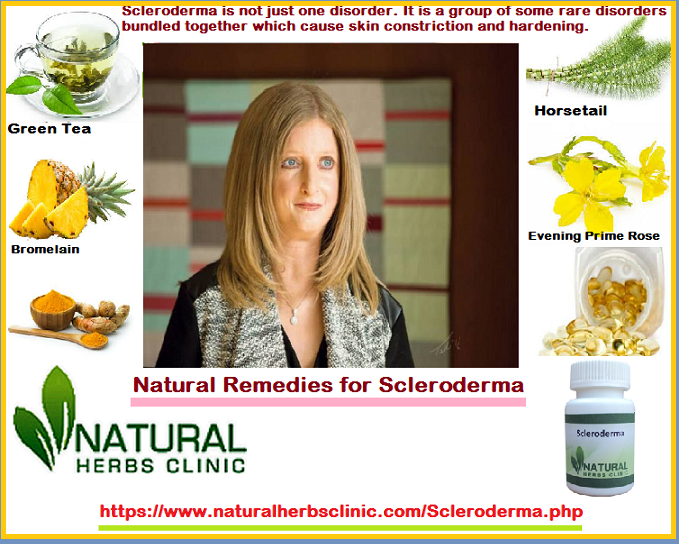 Natural Remedies for Scleroderma