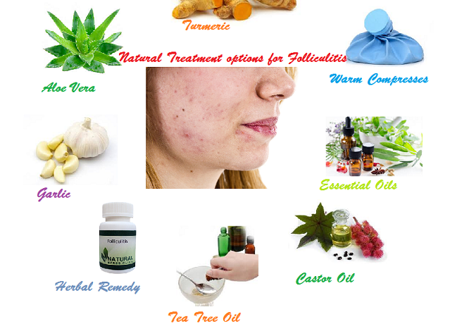 Natural-Proven-Way-for-to-Folliculitis-Treatment-1