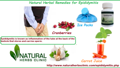 Natural-Herbal-Remedies-for-Epididymitis