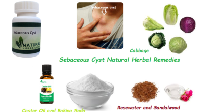 Sebaceous-Cyst-Natural-Herbal-Remedy