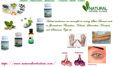 Herbal-Alternative-Medicine-Natural-Herbs-Clinic