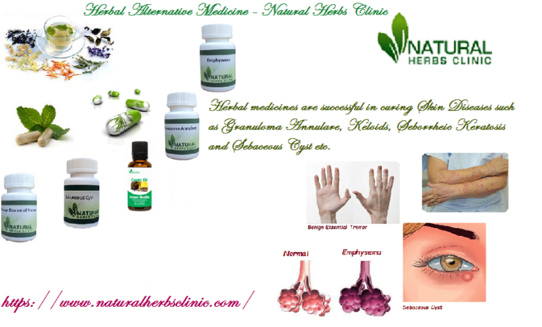 Herbal-Alternative-Medicine-Natural-Herbs-Clinic