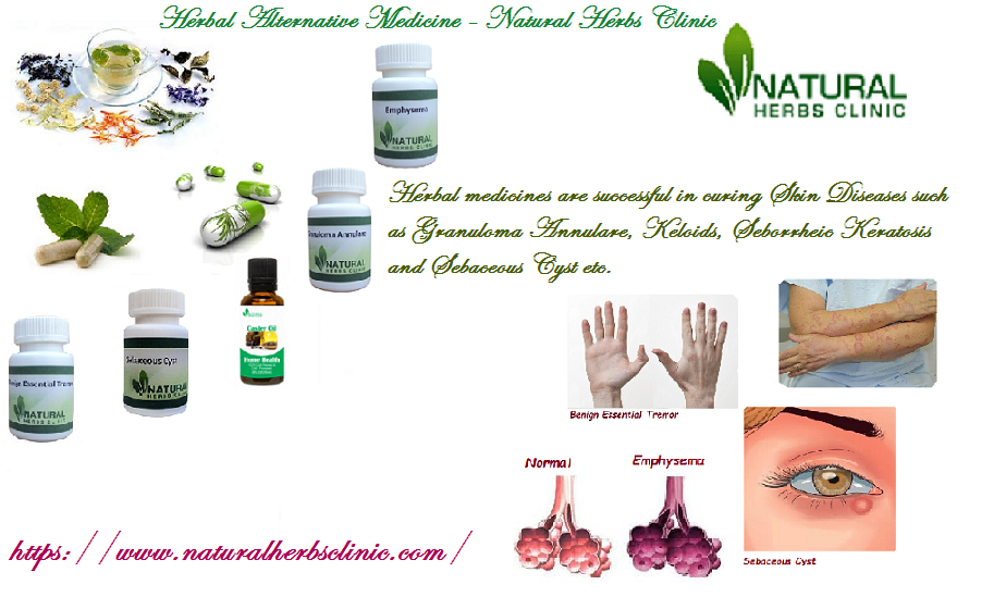 Herbal Alternative Medicine Natural Herbs Clinic