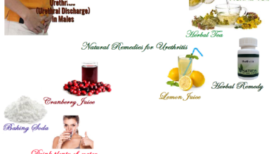 Natural-Remedies-for-Urethritis 1