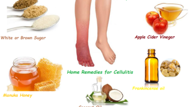 Natural-Remedy-for-Cellulitis