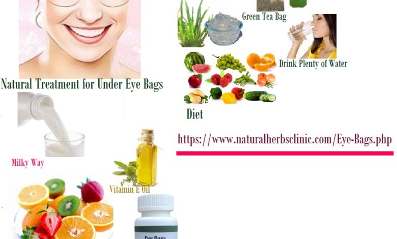 Natural-Treatment-for-Under-Eye-Bags