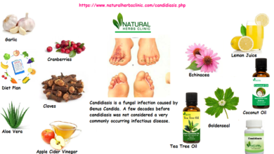 11-Natural-Herbal-Treatment-of-Candidiasis