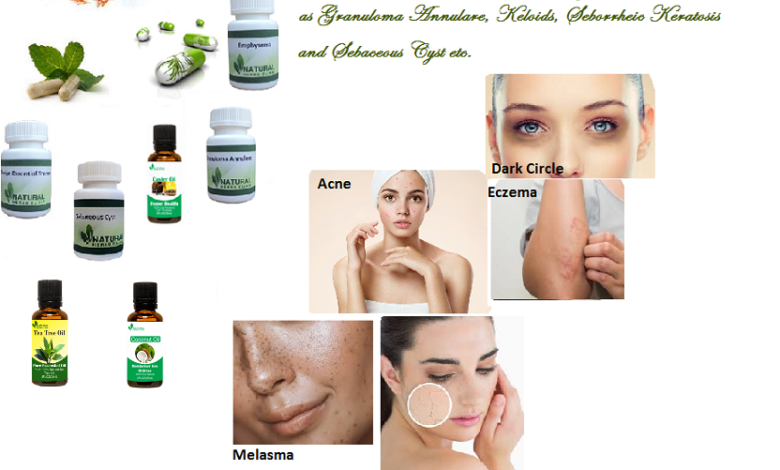 Natural-Herbal-Remedies-for-Skin-Diseases