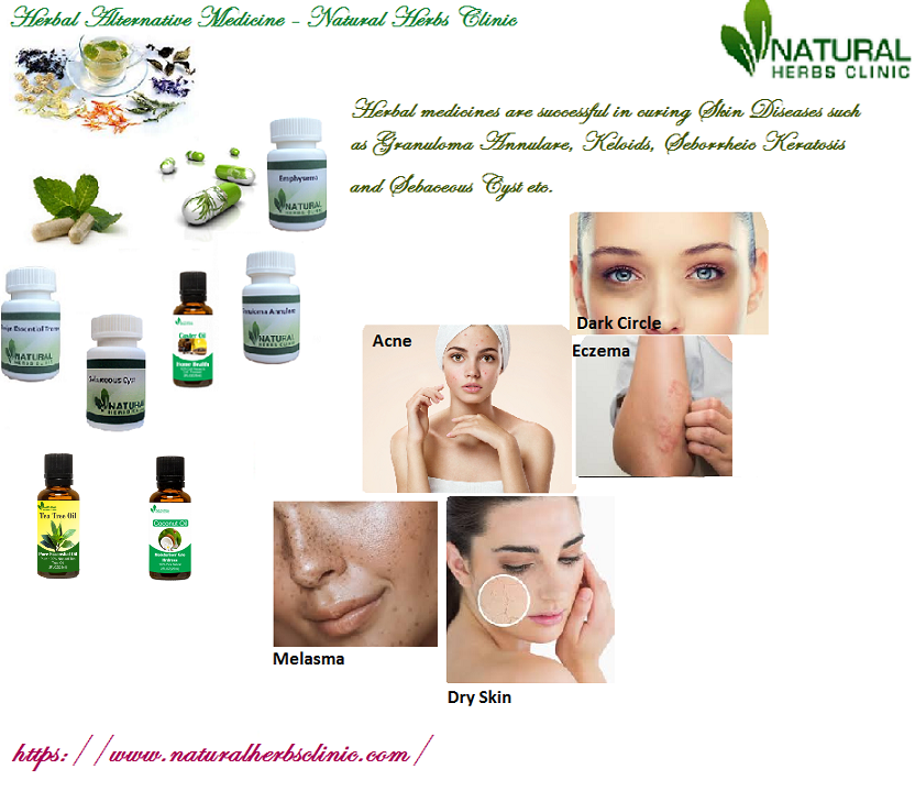 Natural Remedies for Skin Diseases