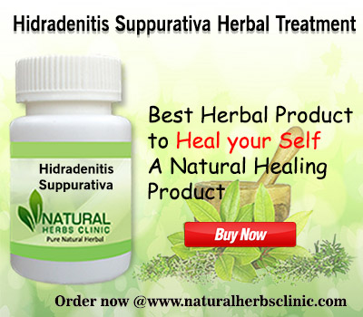 Natural Remedies for Hidradenitis Suppurativa 