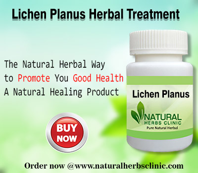 Natural Remedies for Lichen Planus