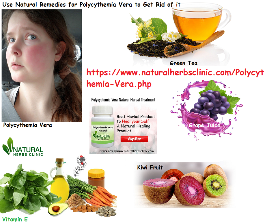 Natural Remedies for Polycythemia Vera