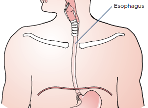 Natural-Remedies-for-Achalasia-to-Decrease-the-Symptoms