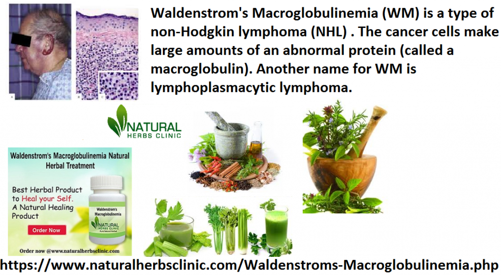 Natural Remedies for Waldenstrom's macroglobulinemia